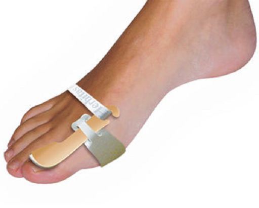 Hallux valgus splint Left